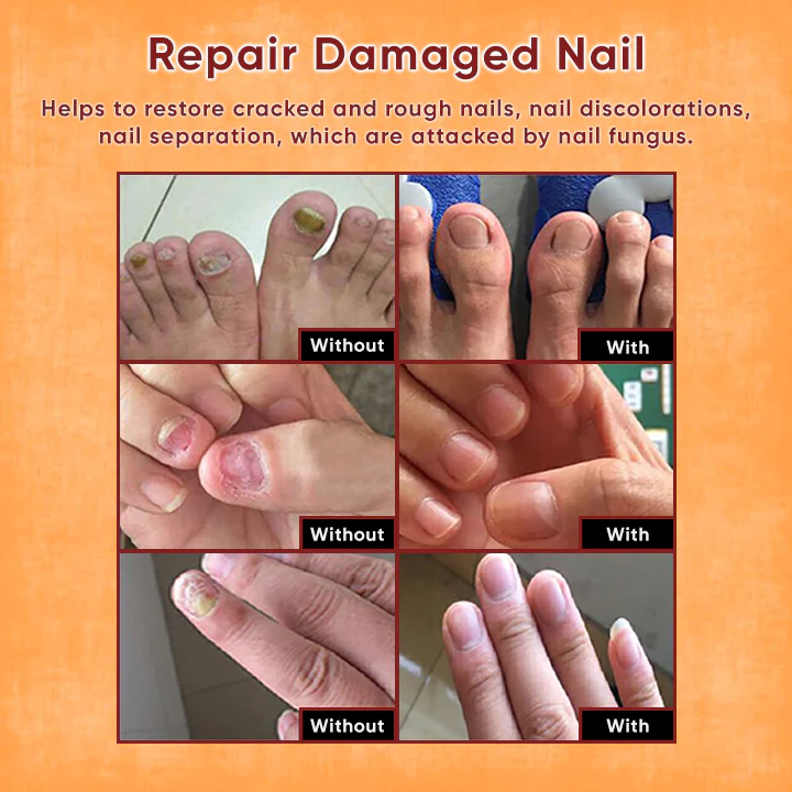 NailsHealer™ Nail Repair Essence