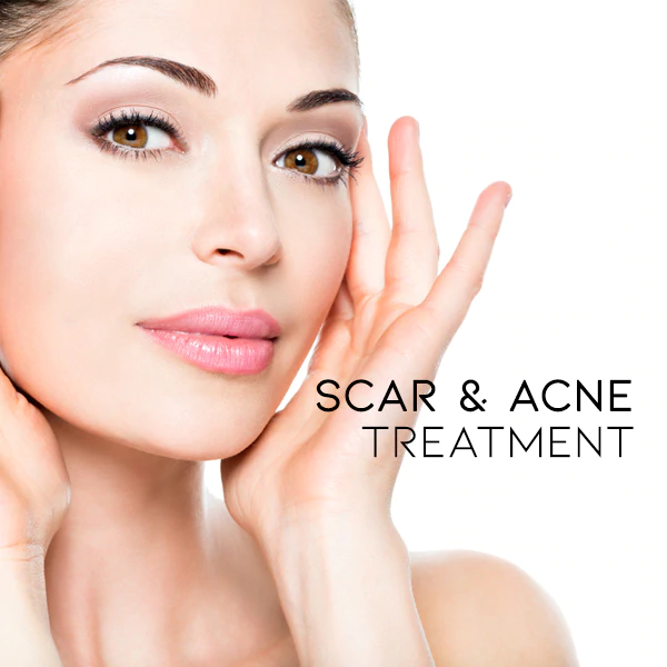 AcneAway™ Scar & Acne Bump Removal Cream