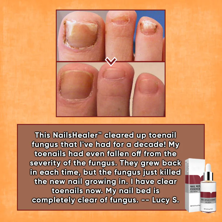 NailsHealer™ Nail Repair Essence