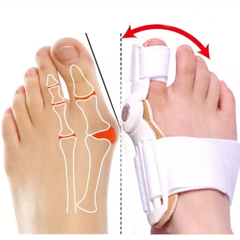 🔥HOT SALE 30% OFF🔥【DOCTOR RECOMMENDED】BUNION CORRECTOR FOR MEN & WOMEN